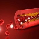 젊은 층 ‘혈액에 기름 끼는 병’ 증가… 증상 없어, 이미지