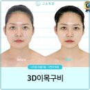 더고운피부 이미지