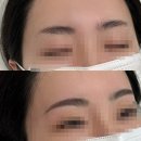 합정역 홍대 자연눈썹 문신 “팽 브로우”믿고 맡기는 원장님 금손