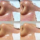 부천피부관리 피부 맞춤 프롬미 후기