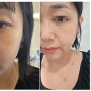 웰스케어 | 봉담피부관리 두스킨 어썸웰스파, 원데이 진정케어 체험 후기