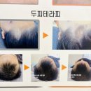 에스에스비 이미지