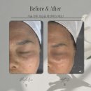 올가뷰티송천아이파크점 | 전주피부관리 올가드림뷰티 송천점 전주웨딩관리 두피관리 추천