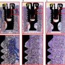 마음심는치과의원 | 풀아치 임플란트 치과 가격 '비교'할 이유가 없습니다.