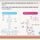 욕창 뜻과 단계별 증상과 예방 방법 이미지