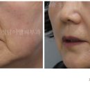 청담이엘피부과의원 이미지