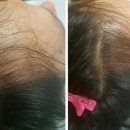 수아헤어 네이버블로그