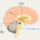 파킨슨병 &파킨슨 증후군 모든 것 알기 이미지