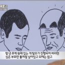 모발이식의 원리 이미지