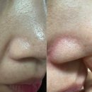 허브PC방(나운점) | 군산 피부샵 예신관리 올가뷰티 나운 한울점 솔직후기