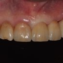 라이브치과기공소 이미지