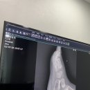 케이에스병원 | 소아정형외과 안산 케이에스병원 후기-일과성 고관절 윤활막염 진단받은 4살 아이