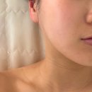 라인슈퍼 | 쌍문동 피부관리 잘하는 곳 수분충전부터 V라인까지 소원뷰티 슈퍼리프팅 후기