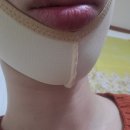 선메디텍 네이버블로그