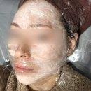 양재(기초) | 강남 엘라비에 리투오 스킨부스터 양재역 피부과 추천 통증 후기 7일차! 🧏🏻‍♀️