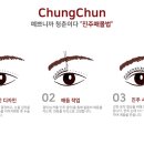 티나성형외과의원 티스토리