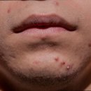 투명피부과의원 이미지