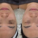 베네핏에스테틱 이미지