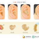 매직보청기 이미지