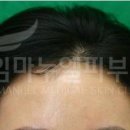 임마누엘헤어 이미지