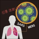 신종 코로나 바이러스 우한폐렴 확산 비상. 판데믹 사스, 메르스, 우한 폐렴 비교 및 예방법-중국 감염 사스 10배, 현재 확진자 국가 현황 이미지