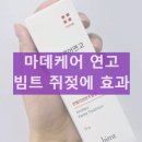 그린약국 | 빔트 마데케어 연고 약국 성분 쥐젖제거 후기 내돈내산 후기 사용법