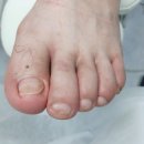 레푸스&에이레네