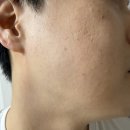에이벨 | [제품협찬] 진정 및 피부장벽 개선 꿀템! 테라피토에이벨 테라피토 인텐시브 큐어 오인트먼트 사용 후기