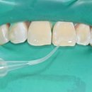 연세하얀치과의원 이미지