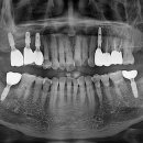 커스텀기공소 이미지