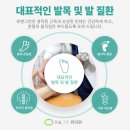 대전 원신흥동한의원, 찌릿한 족저근막염 시 뒤꿈치 통증 체외충격파만큼 효과있는 치료 방법은?