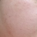 한국리바이탈 이미지