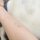 제일메디컬의원 | 진주 하얀메디컬의원-대상포진 입원 치료 후기(수요일~월요일, 6일간)