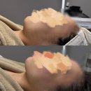 6324 | 구미 피부관리 추천, 치리에스테틱 리프팅 후기