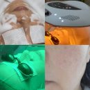 옥정약국 | [양주 피부관리] 루아에스테틱 옥정점 방문 후기