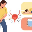 방광이 자주 찰 때 과민성 방광 자가진단 이미지
