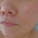 블랑드보떼 이미지