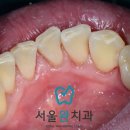 서울완치과 이미지