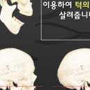 연세엘라인치과의원 네이버블로그