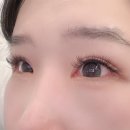 비니래쉬앤뷰티 네이버블로그