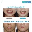 바른웅치과의원 이미지