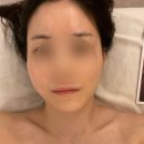 엘에스테틱 | 신도림 호텔식 에스테틱 엘뷰티 레미디 하이푸 리프팅 솔직후기