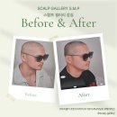방배로18길 24-8 | 잠실SMP 탈모 고민 끝! '스칼프갤러리 잠실'에서 찾은 자신감 두피 커버 1회차 방문 후기
