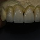 뉴치과기공소 이미지