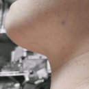 미모던피부과의원 | 서울 강남구 수서동 탈모관리 미모던피부과의원 위치 가격 후기