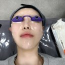 아비쥬의원여의도 | [여의도 피부과] 아비쥬의원 환절기 피부관리 N년째 내돈내산 리얼 후기