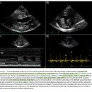 68마리의 개를 대상으로 개에서의 hypertrophic cardiomyopathy (HCM)을 다룬 논문 이미지