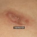 서울화봄의원 이미지