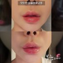 봄눈피우다의원 이미지