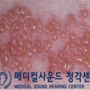 메디칼사운드 이미지
